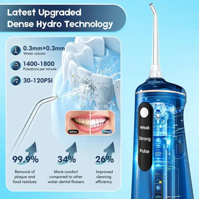 Us Warehouse Products Portable Oral Irrigator Water Flosser Teeth Cleaning Dental Water Flosser Oral Irrigator